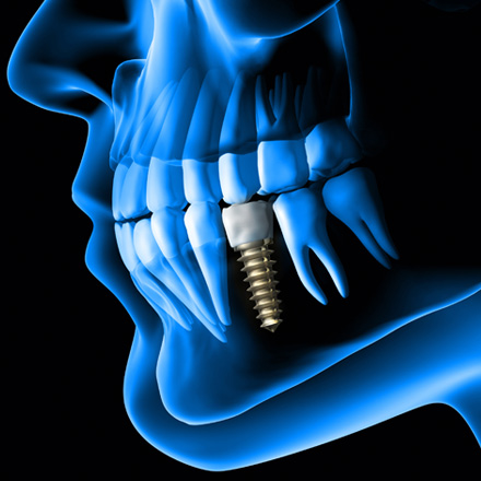 Restorative & Prosthetic Dentistry Services