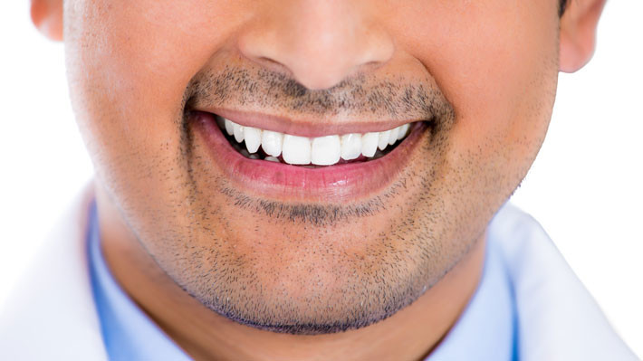 Porcelain Crowns vs Porcelain Veneers