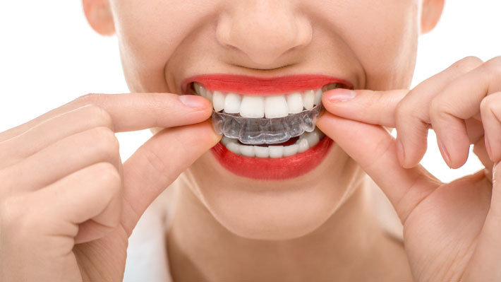 How to Recognize, Treat, and Prevent Teeth Grinding