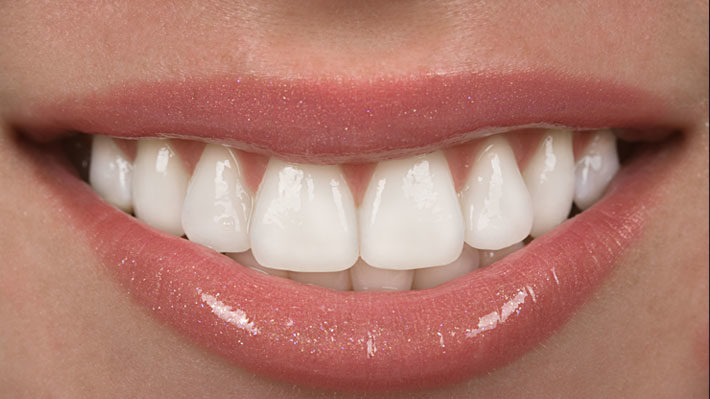 Why Get a Smile Makeover? The Survey Says…