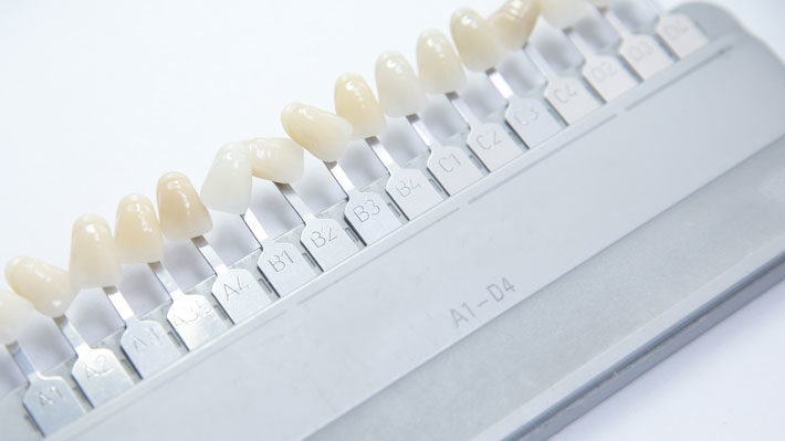 The Pros and Cons of Porcelain Veneers