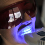 Five Frequently Asked Questions About Teeth Whitening
