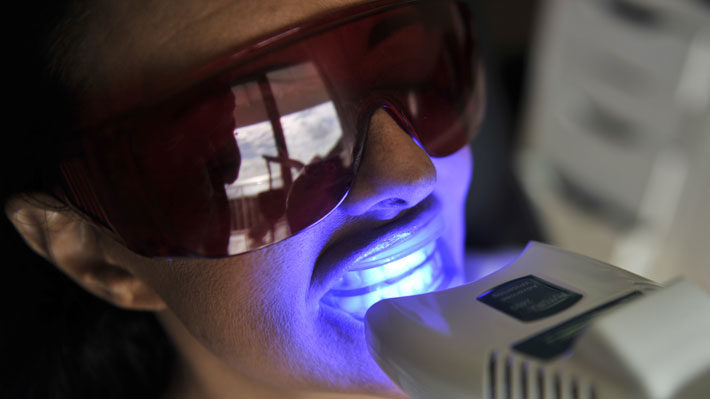 Five Frequently Asked Questions About Teeth Whitening