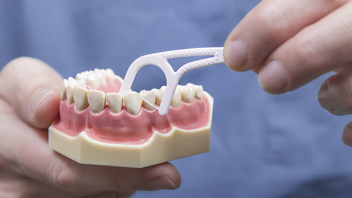 Dentists Frustrated by AP Report Questioning Flossing’s Value