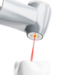 How Technology May Make Root Canals Obsolete