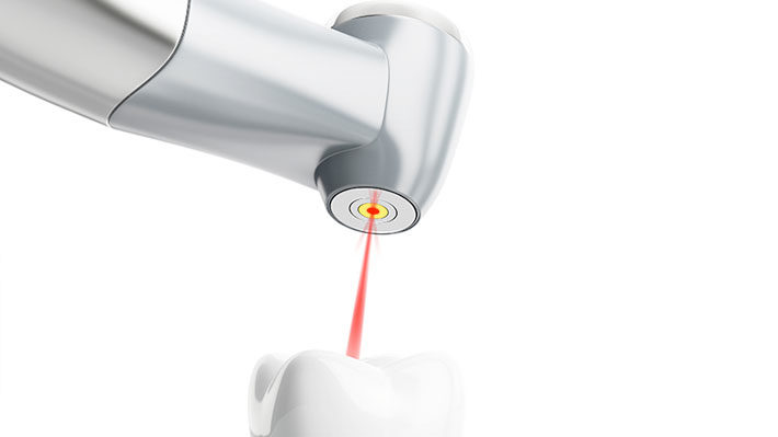 How Technology May Make Root Canals Obsolete