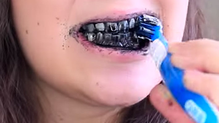 Charcoal Teeth Whitening? Don’t Believe Everything You Read Online!