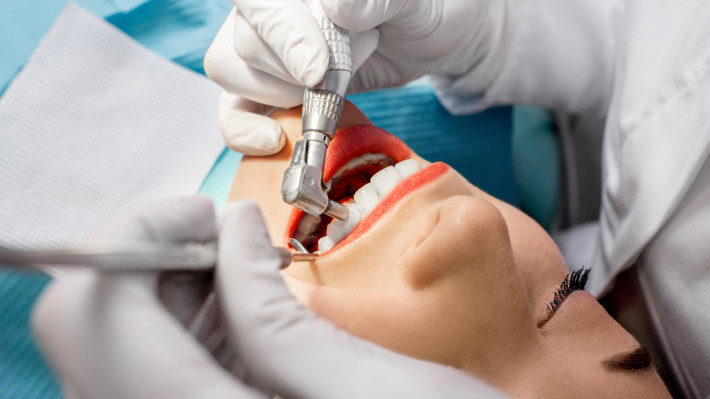 Is One-Hour Whitening Just What the Dentist Ordered? - Dr. Karen Kang