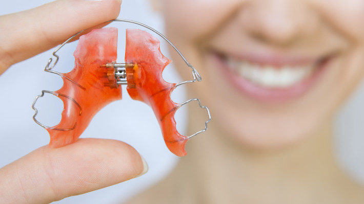 Beyond the Braces: Maximize Your Orthodontic Experience