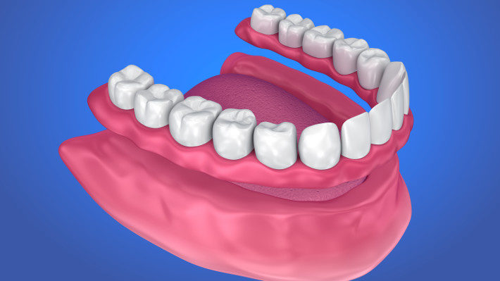 When Removable Dentures are Your Best Tooth Replacement Option