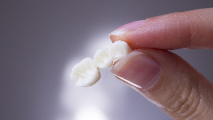 Could a Dental Bridge Be the Best Solution for Your Single-Tooth Replacement Needs?