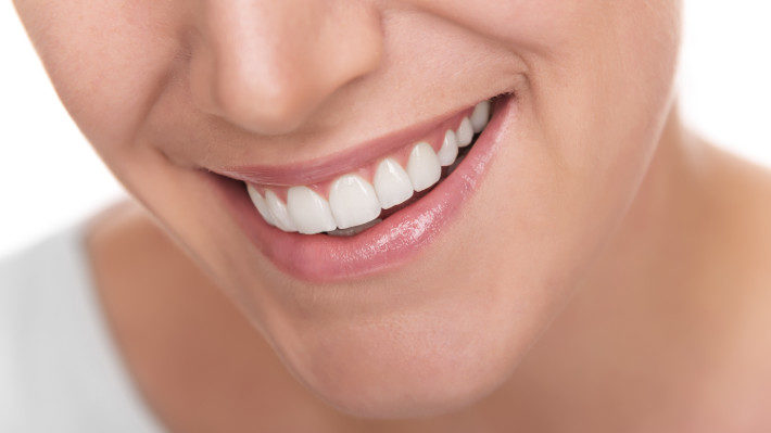 Porcelain Veneers: Dispelling the Myths