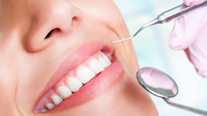 Three Essential Benefits Veneers Provide