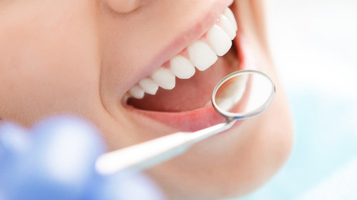 The Keys to Superior Dental Health