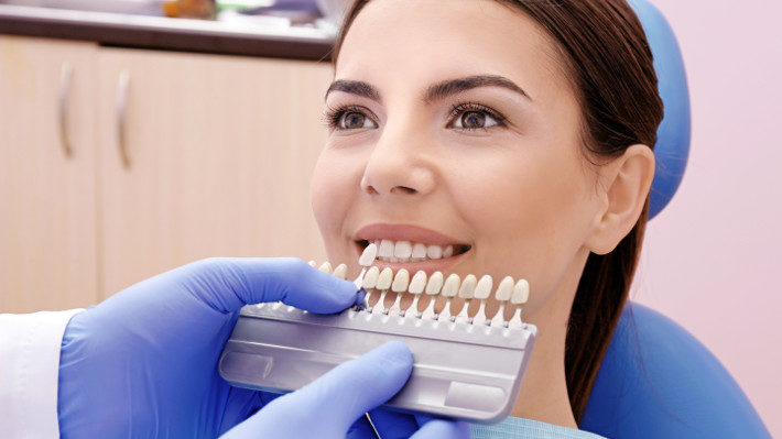 The Superiority of Tooth-Colored Dental Fillings