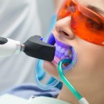 How Often Should You Get Your Teeth Whitened?