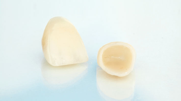 Porcelain dental crowns